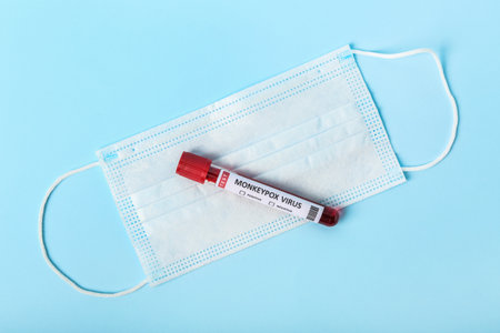 Blood sample with medical mask on blue background. Monkeypox virus concept