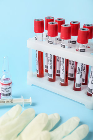 Monkeypox vaccine with syringe and blood samples on blue background