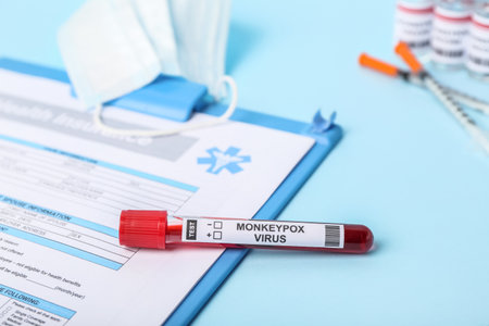 Blood sample with clipboard on blue background, closeup. Monkeypox virus concept