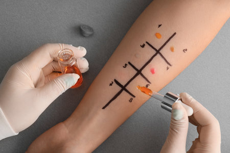 Doctor with dropper making allergy skin test on patient's hand in clinic, closeupの写真素材