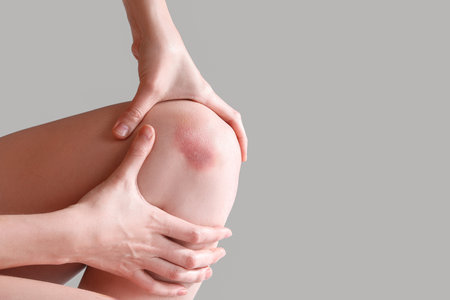 Young woman with bruised knee on gray background, closeupの写真素材