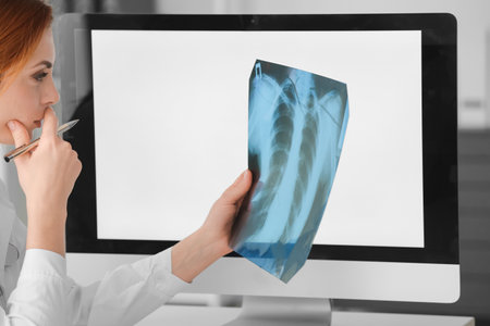 Pulmonologist with x-ray image of lungs in clinic