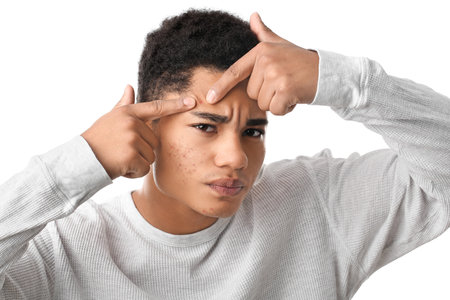 African-American teenage boy with acne problem on white background