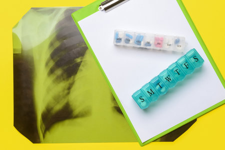 X-ray scan of lungs with clipboard and pills on color background