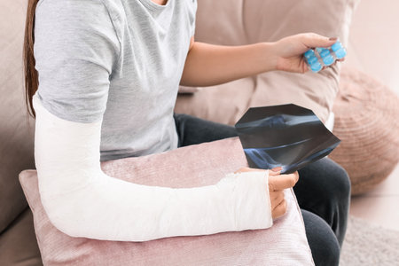 Young woman with broken arm at homeの写真素材