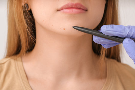 Dermatologist examining patient in clinic, closeupの写真素材