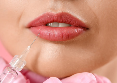 Young woman receiving filler injection in lips, closeupの写真素材