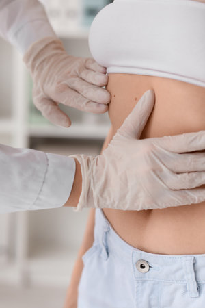 Dermatologist examining moles on young woman's belly in clinic, closeupの写真素材