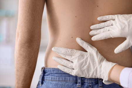 Dermatologist examining mole on young man's back in clinic, closeupの写真素材