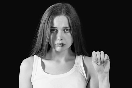Bruised young woman showing fist on dark background, closeup. domestic violence conceptの写真素材