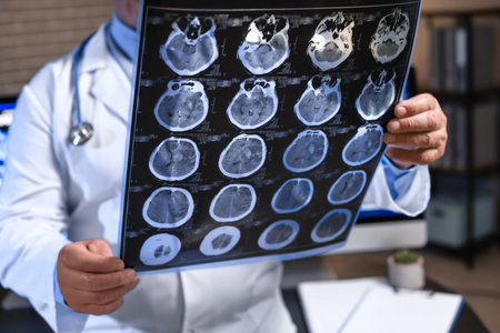 Senior neurologist with MRI scan of human head in clinicの写真素材