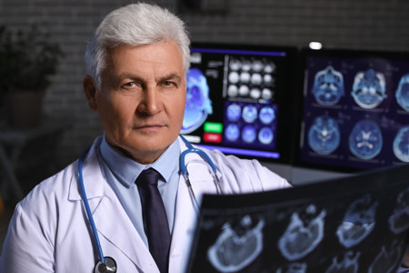 Senior neurologist with MRI scan of human head in clinicの写真素材