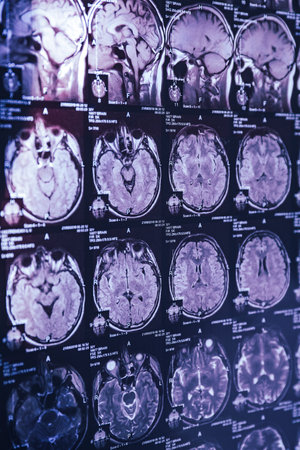 MRI scan of human head, closeup