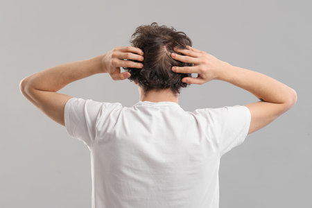 Young man with hair loss problem on gray background, back viewの写真素材
