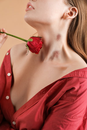 Woman with love bites on her neck and rose flower against color background, closeupの写真素材