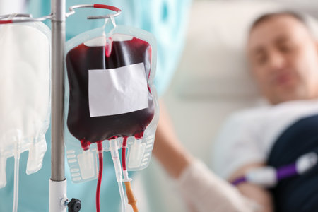 Blood pack for transfusion in clinic, closeupの写真素材
