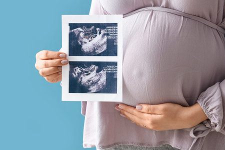 Young pregnant woman with sonogram image on blue background, closeup