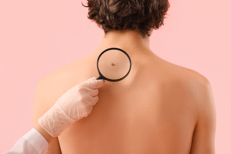 Dermatologist examining mole on young man's back with magnifier against pink background, closeupの写真素材