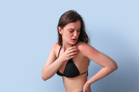 Allergic young woman with sunburned skin on blue background