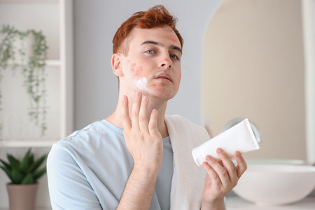 Teenage boy applying remedy for acne in bathroomの写真素材