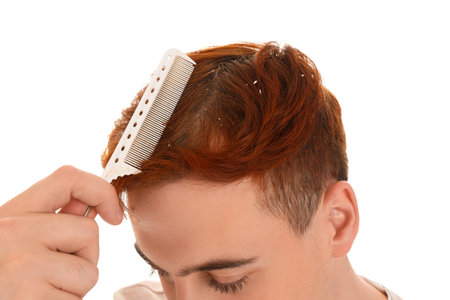 Young redhead man with problem of dandruff combing hair on white background