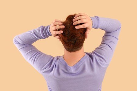 Young redhead man with problem of dandruff on beige background, back viewの写真素材
