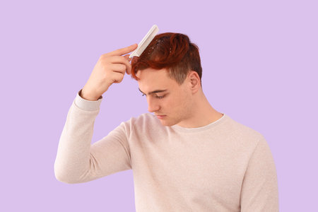 Young redhead man with problem of dandruff combing hair on lilac background