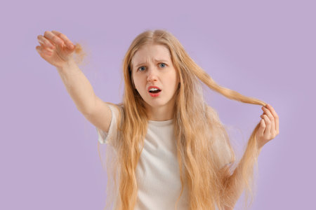 Worried young woman with hair loss problem on lilac backgroundの写真素材