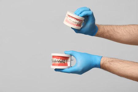 Dentist hands with jaw models on gray background. World Dentist Dayの写真素材