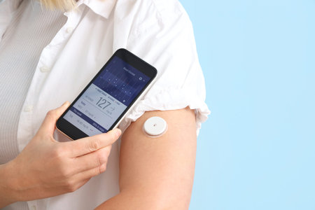 Diabetic woman with glucose sensor using mobile phone for measuring blood sugar level on blue...