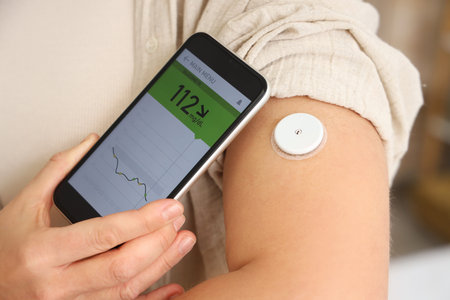Diabetic woman with glucose sensor using mobile phone for measuring blood sugar level in bedroom,...