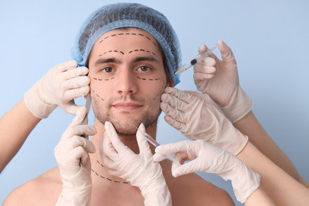 Plastic surgeons with tools and young man with marked face against blue background, closeupの写真素材
