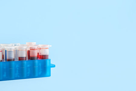 Many test tubes with colorful samples in stand on blue background