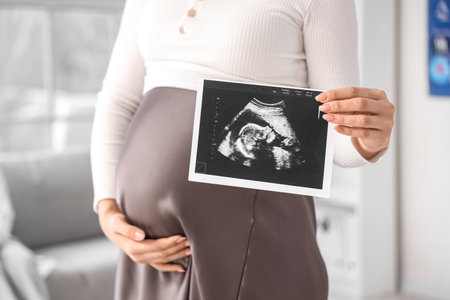 Young pregnant woman with sonogram image in clinic, closeupの写真素材