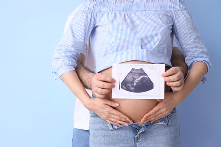 Young pregnant woman and her husband with sonogram image on blue background, closeup