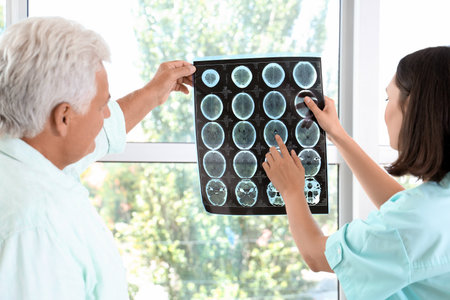 Female doctor showing x-ray scan to senior patient in medical officeの写真素材
