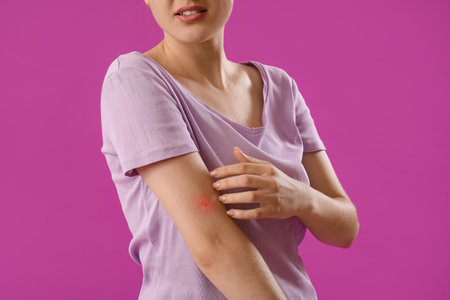 Young woman with mosquito repellent spray on purple background, closeupの写真素材