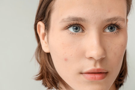 Beautiful young woman with acne problem on gray backgroundの写真素材