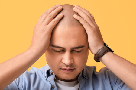 Stressed bald young man on yellow background, closeup