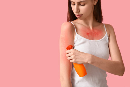 Allergic young woman with red sunburned skin applying cream on shoulder on pink background
