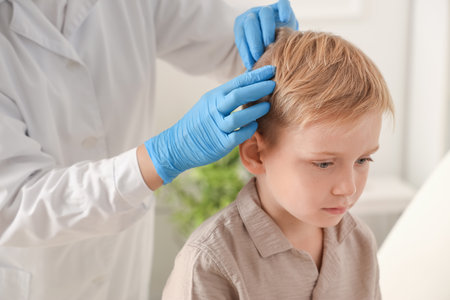 Female doctor checking little boy's head for pediculosis in clinic, closeupの写真素材
