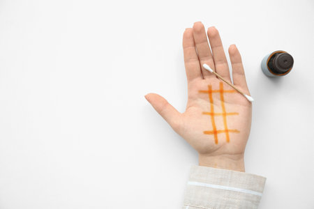 Female hand with iodine mesh, cotton swab and bottle of iodine on white background. Top viewの写真素材