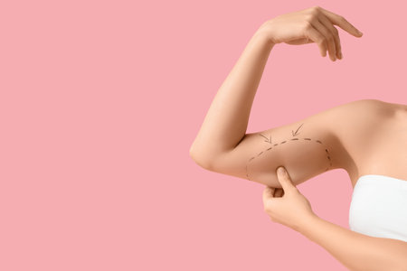 Arms of woman with marks on pink background. Liposuction conceptの写真素材