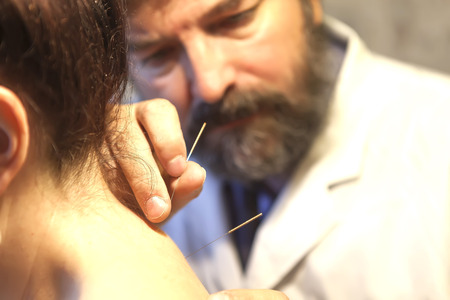 An experienced physician treats acupuncture needles.の写真素材