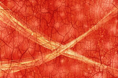 Coronavirus infected blood flows through a vessel.の写真素材