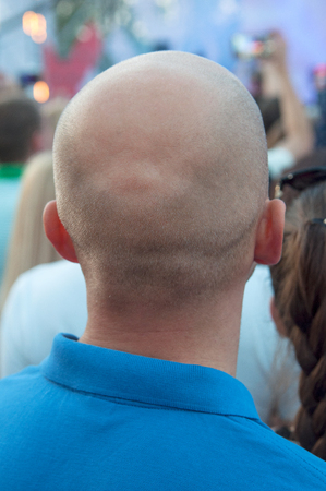 Nape of a bald middle-aged man in a blue t-shirt in the city. Rear view of bald man.  The problem of age baldnessの写真素材