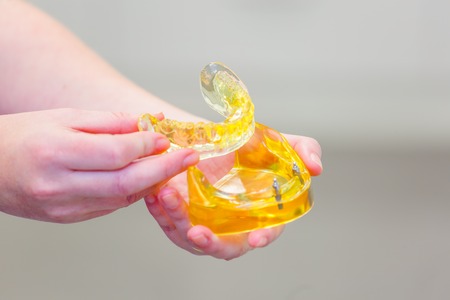 Hands holding a set of dentures. False teethの写真素材