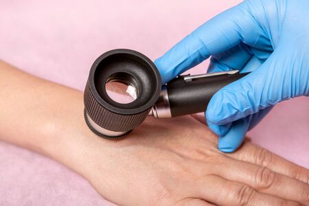 Dermatoscopy skin examination.