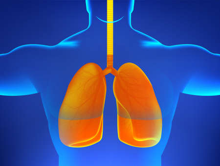 X-ray human body with sick lungs, pneumonia, virus, asthma or other diseases associated with the human lungs. 3D human body hologram and orange lungs signifying illness or infection. Vector healthcareのイラスト素材