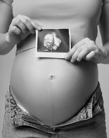 Black and white photo of Pregnant woman with ultrasound scan in hands near belly. Female is holding sonogram baby embryo image over a pregnant tummy. Concept of pregnancy and maternal health.の写真素材